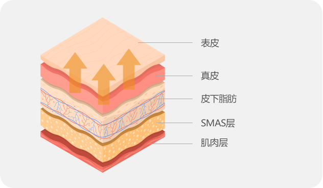 Traditional Facelift